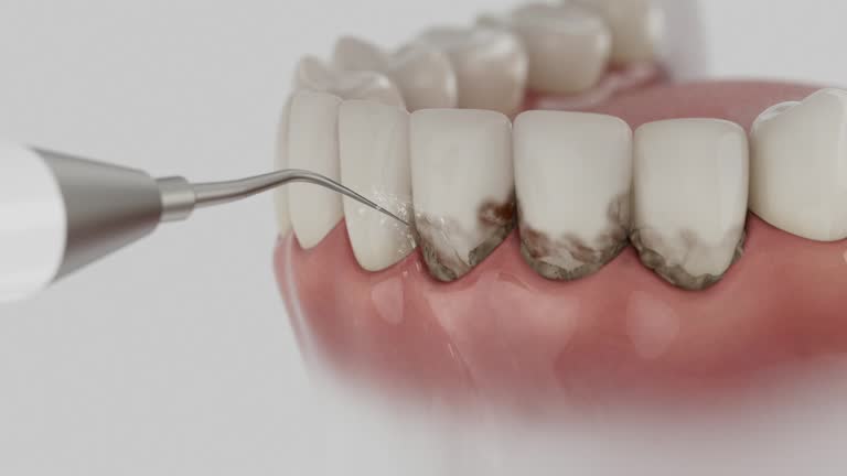 Trusted Teeth Cleaning And Checkup service in Summit, MS - Dentist Open Now